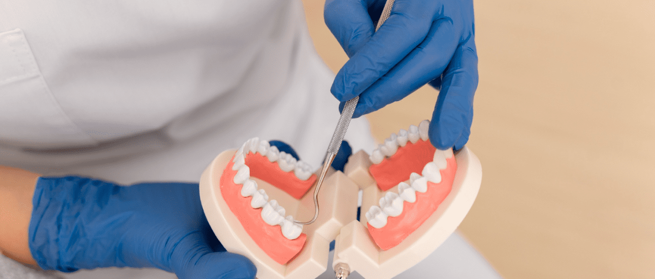 Dental professional wearing blue gloves demonstrates overbite correction using a dental model with white teeth and pink gums, holding orthodontic tools to show treatment techniques at Sweet Smiles Orthodontics in Arlington, MA