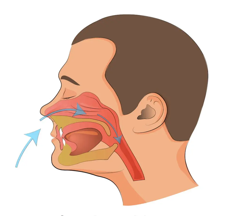 Diagram of a head at Sweet Smiles Orthodontics in Arlington, MA, showing mouth-breathing airflow path into the respiratory tract.