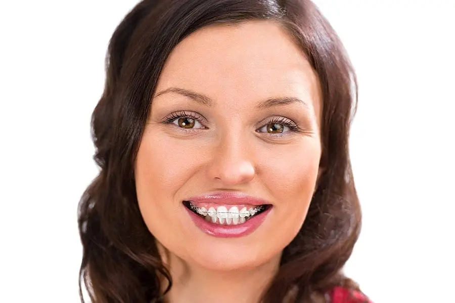 A woman with long brown hair and ceramic braces smiles, representing Sweet Smiles Orthodontics in Arlington, MA, on a white background.