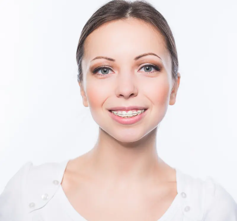 A young woman with straight brown hair and clear braces smiles at the camera for Sweet Smiles Orthodontics in Arlington, MA.