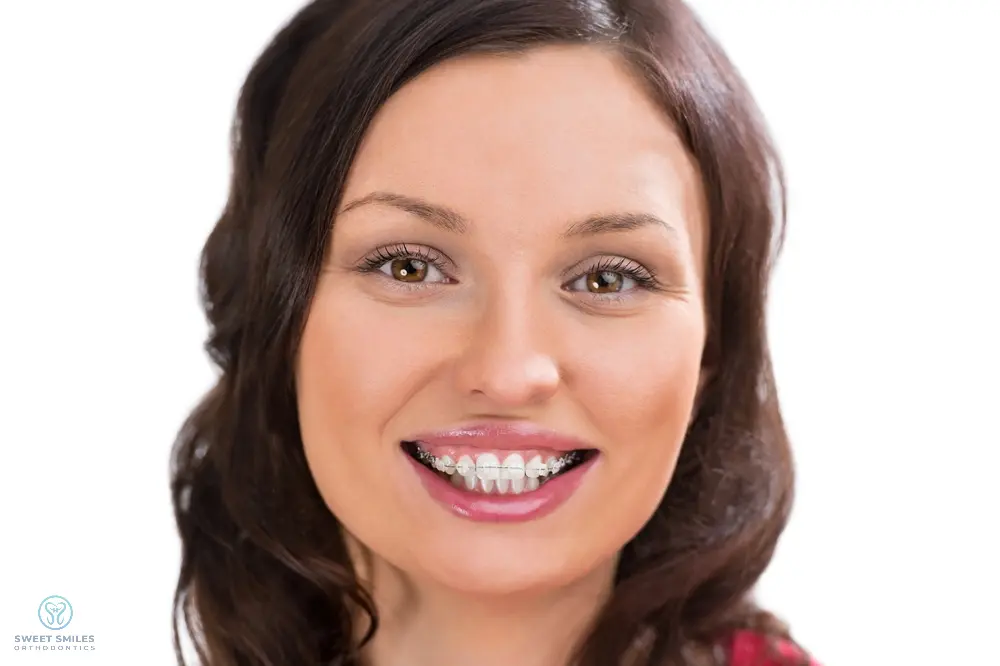 Smiling woman with long brown hair and metal braces, plain white background, Sweet Smiles Orthodontics in Arlington, MA logo shown.