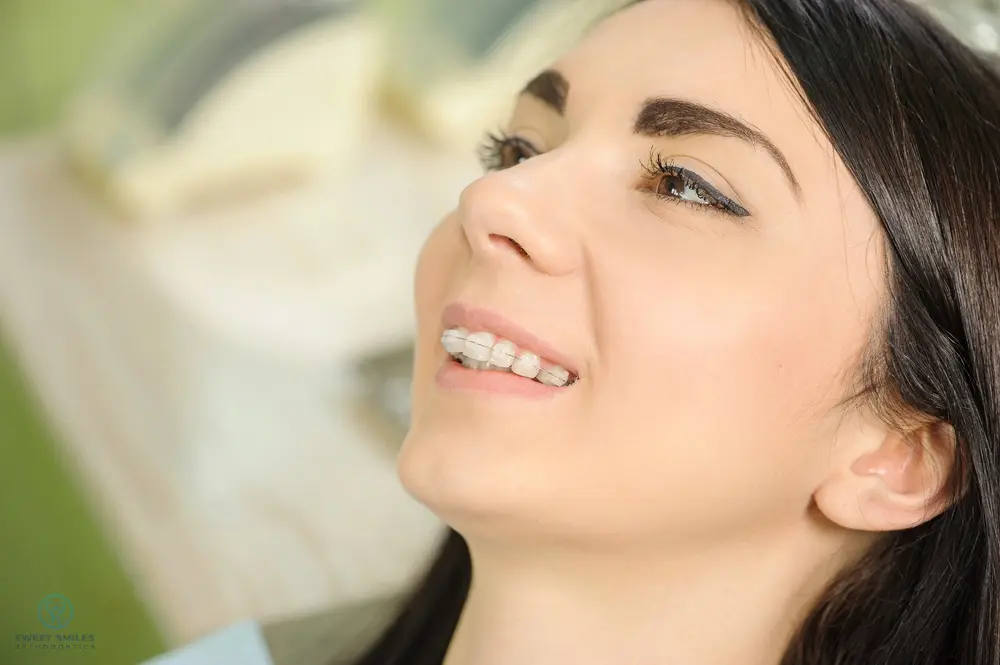 A young woman with dark hair smiles, displaying clear braces at Sweet Smiles Orthodontics in Arlington, MA.