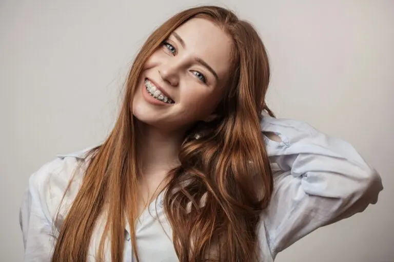 Smiling young woman with red hair, braces, and overbite at Sweet Smiles Orthodontics in Arlington, MA, holding her hair - Overbite vs. Underbite in Arlington, MA